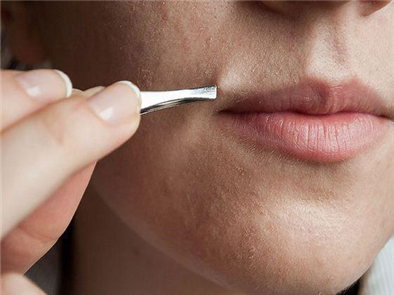  Triệt lông mặt có hại không ?