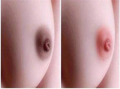 Phun hồng nhũ hoa ở đâu đẹp chị em đã có câu trả lời chưa