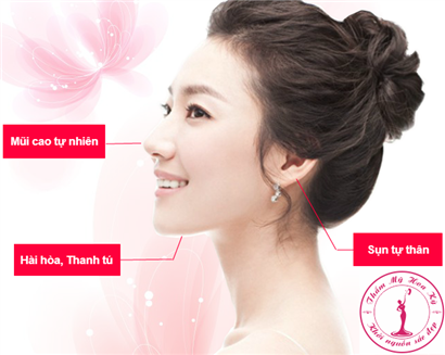 Nâng mũi bọc sụn tự thân