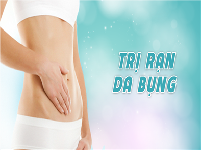 Dịch vụ trị rạn da bụng