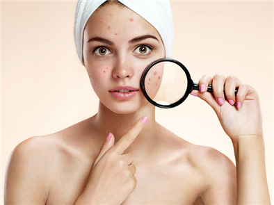 Các phương pháp đơn giản để chăm sóc da mặt mụn
