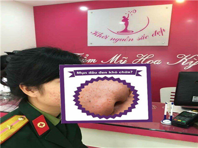 Tuyệt chiêu hết mụn trong 1 đêm – không thể tin nổi