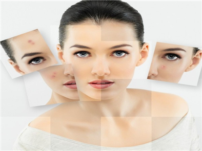 Cách trị vết thâm lâu năm ở mặt hiệu quả nhanh