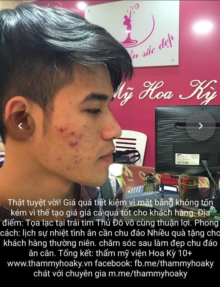 mach-nho-cach-dung-mat-na-dau-oliu-tri-mun-an-toan-cho-da