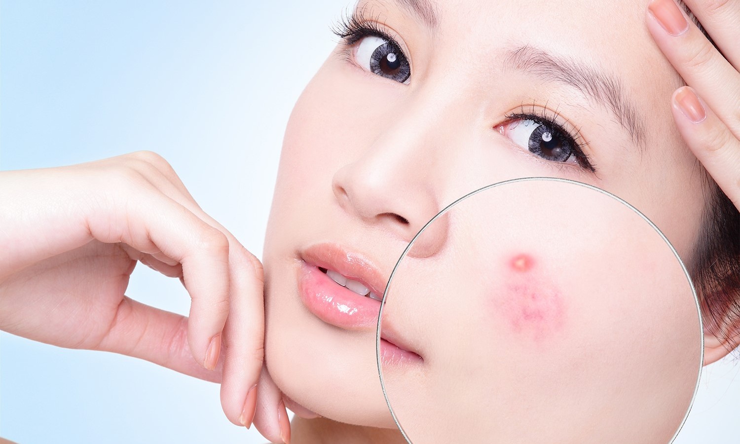 BÍ QUYẾT LÀM MẶT NẠ TRỊ MỤN TRẮNG DA