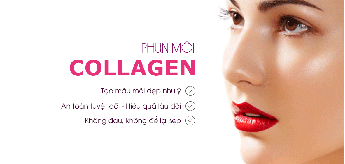 phun-moi-collagen-o-dau-uy-tin