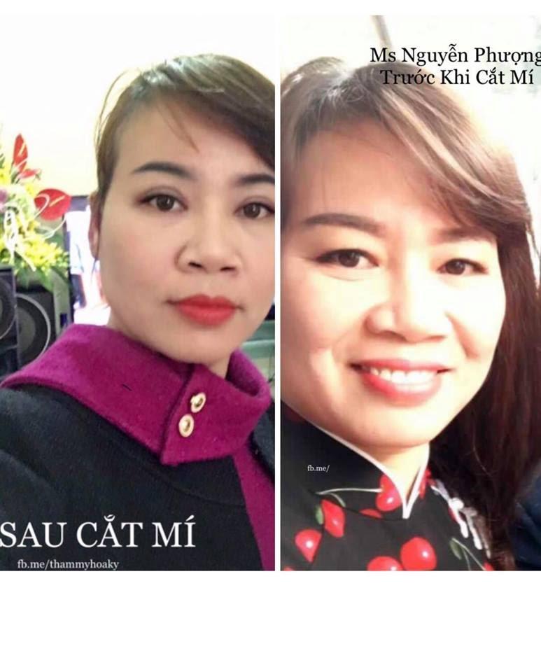 tham-my-vien-o-vinh-phuc