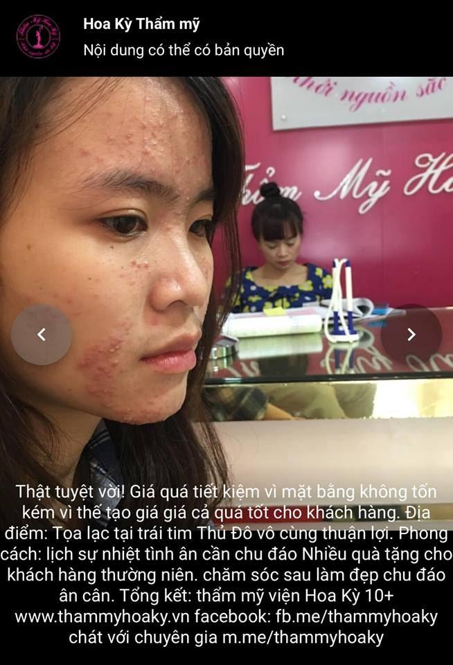 nguyên nhân gây ra mụn bọc