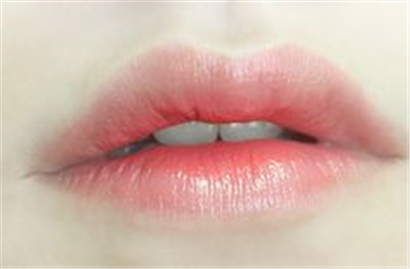 Khử thâm môi ở đâu uy tín