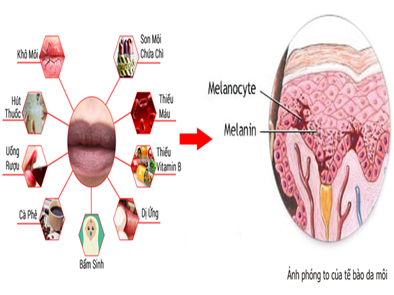 CHIA SẺ KINH NGHIỆM TRỊ THÂM MÔI BẰNG VASELINE HIỆU QUẢ