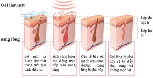 mieng-dan-wax-long-vung-kin