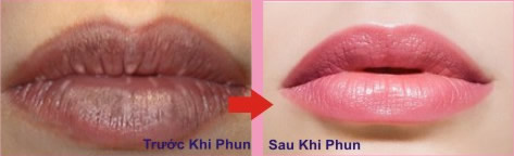 phun-moi-tham
